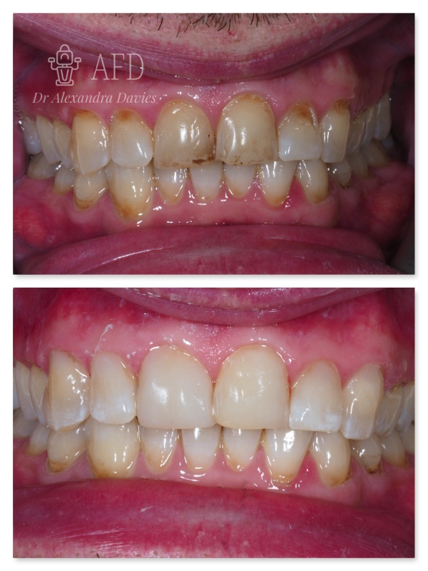 Aesthetics Dentistry image 1