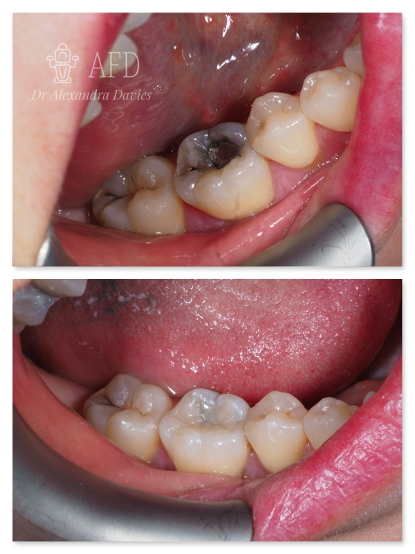 aesthetics dentistry image 10