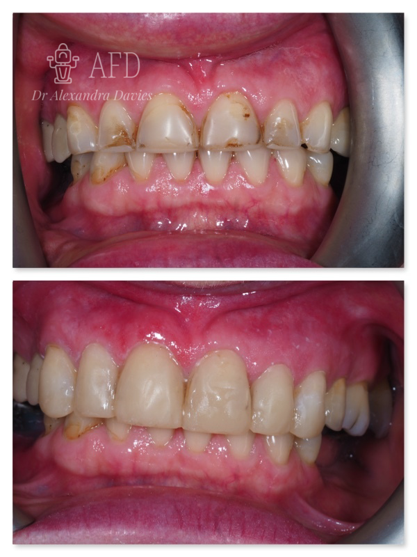 Aesthetics Dentistry image 2