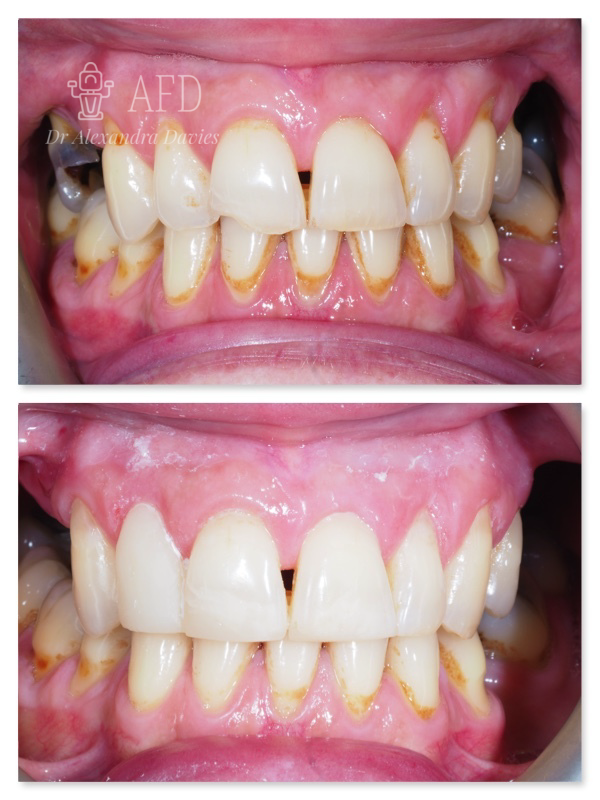 Aesthetics Dentistry image 3