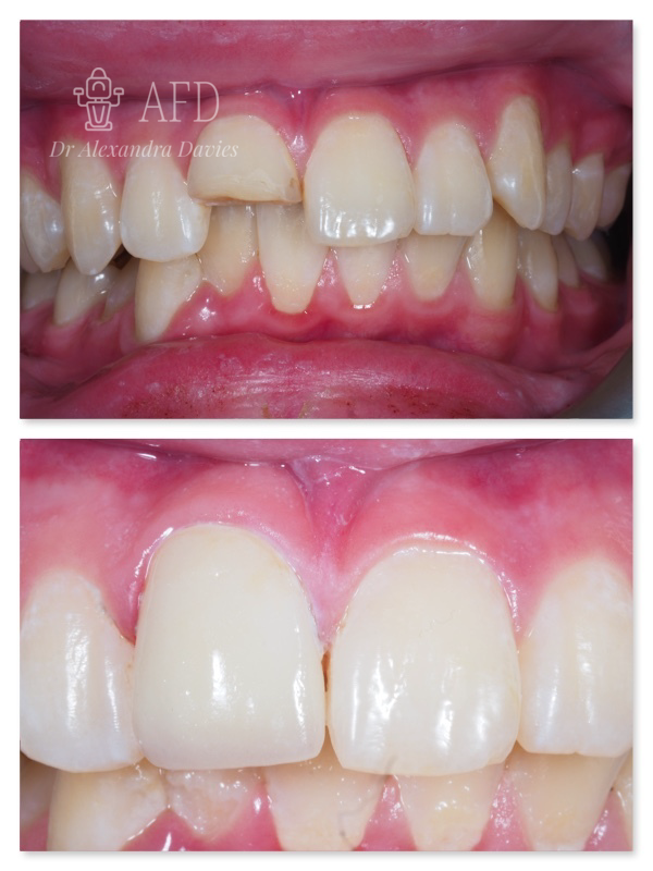 Aesthetics Dentistry image 4