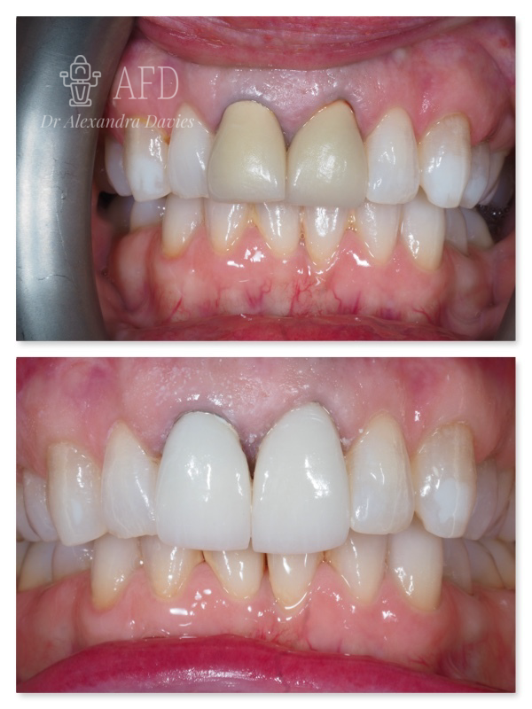 aesthetics dentistry image 5