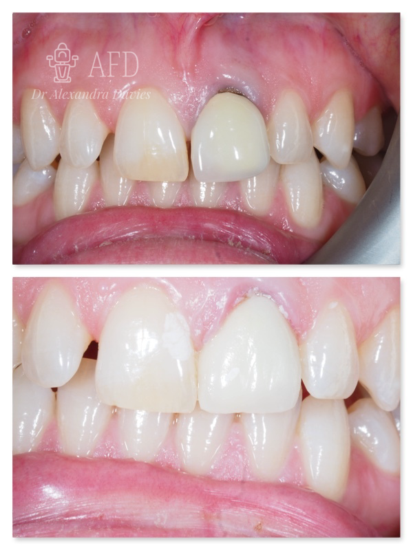 aesthetics dentistry image 6