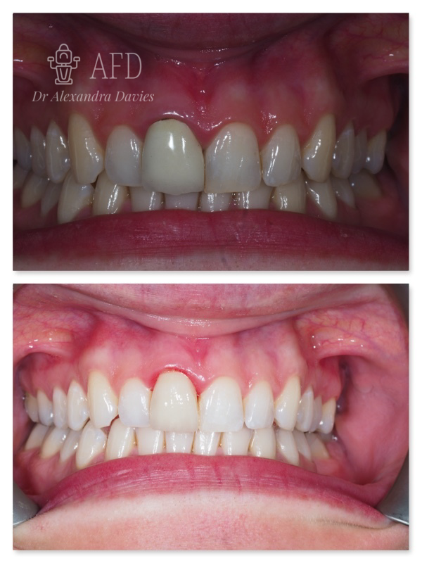 aesthetics dentistry image 7