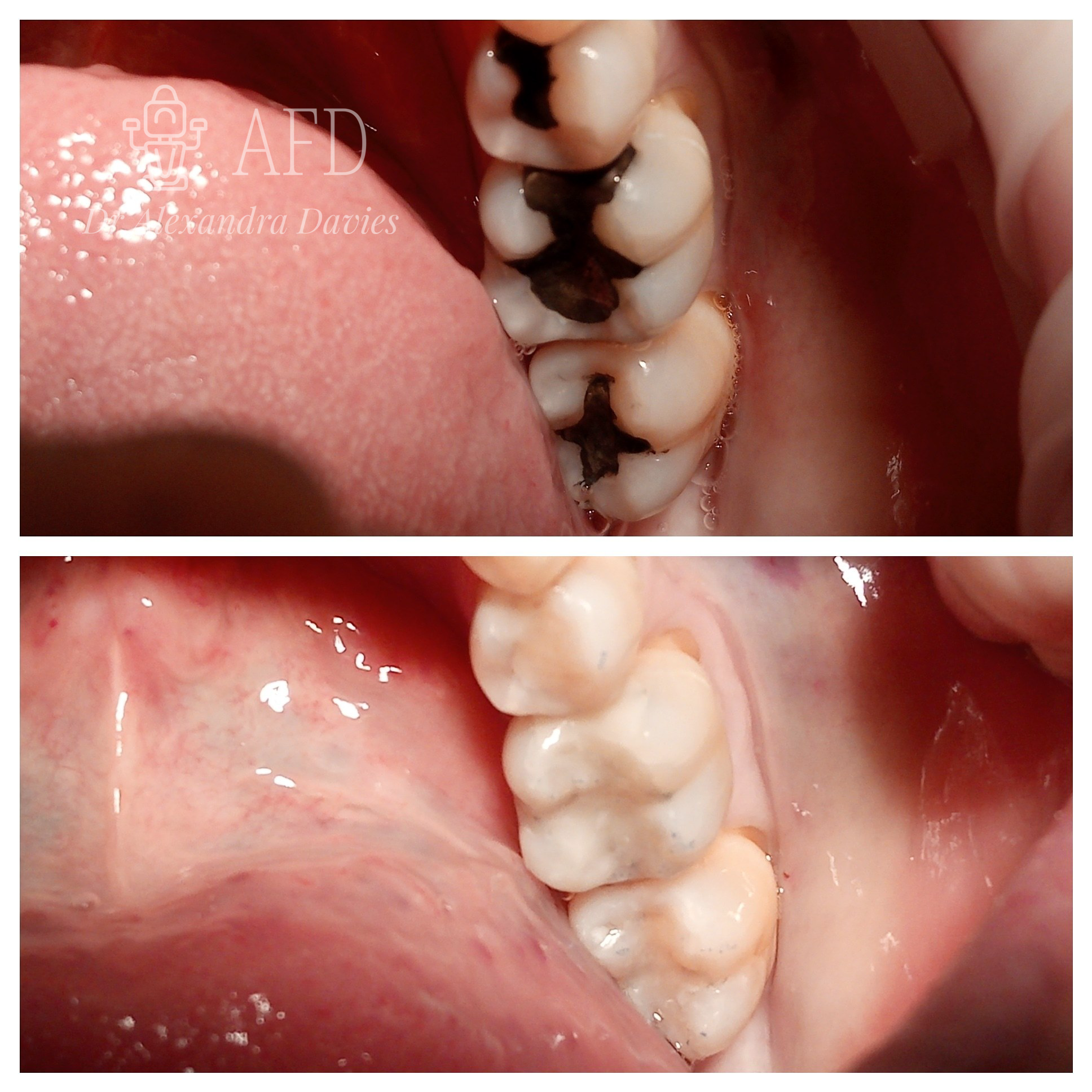 aesthetics dentistry image 9