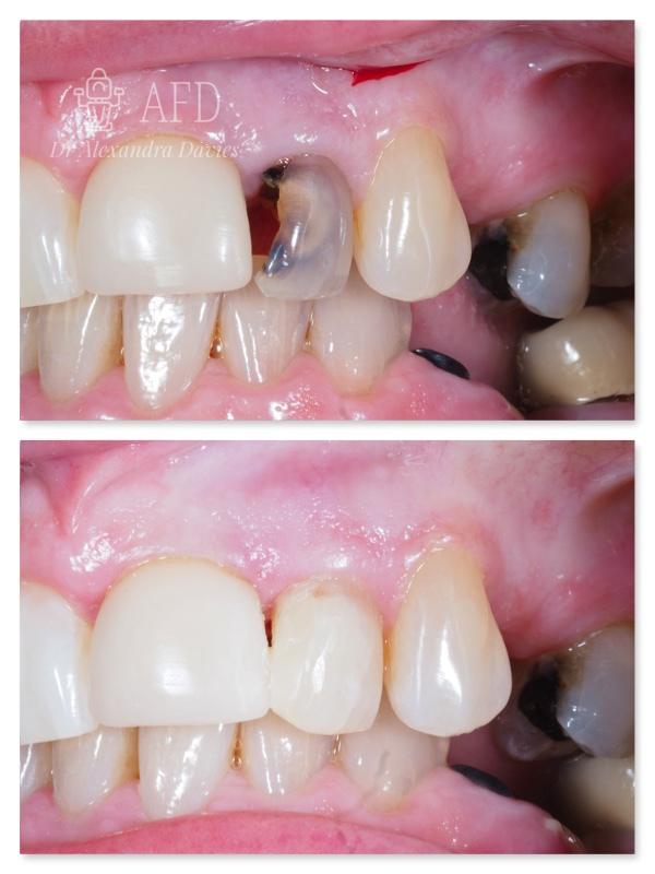 Restorative Dentistry image 2