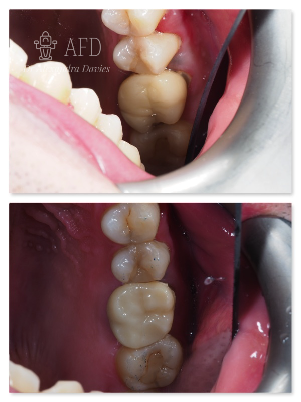 Restorative Dentistry image 3