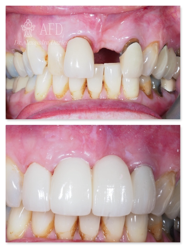 Restorative Dentistry image 5